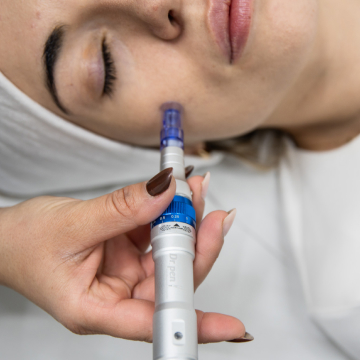 Dispositivo Dermapen utilizado en tratamientos faciales en Villena