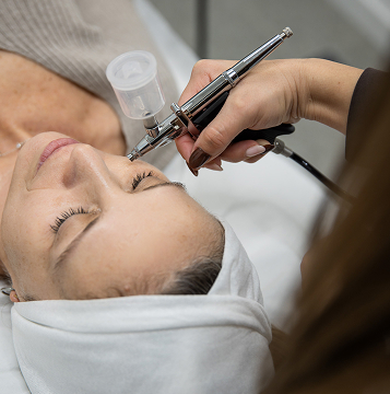 Tratamiento de microneedling con Dermapen para rejuvenecimiento facial en Villena